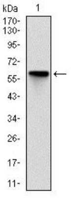 Western Blot: ROCK1 Antibody (1H4)BSA Free [NBP2-37533]
