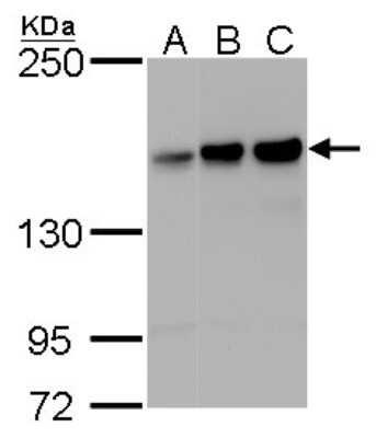 Western Blot: ROCK1 Antibody (261) [NBP2-42917]