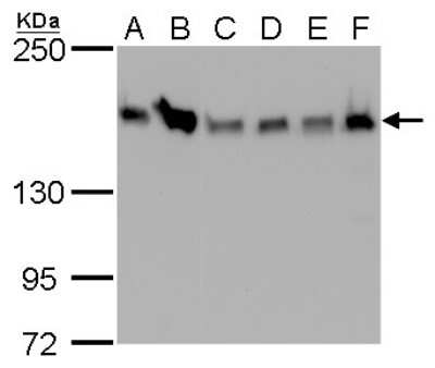 Western Blot: ROCK1 Antibody (261) [NBP2-42917]