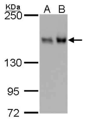 Western Blot: ROCK1 Antibody (261) [NBP2-42917]