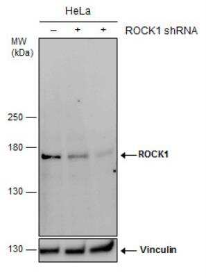 Western Blot: ROCK1 Antibody (261) [NBP2-42917]