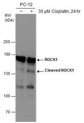 Western Blot: ROCK1 Antibody (261) [NBP2-42917]