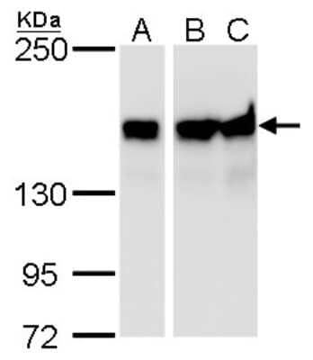 Western Blot: ROCK1 Antibody (464) [NBP2-42918]