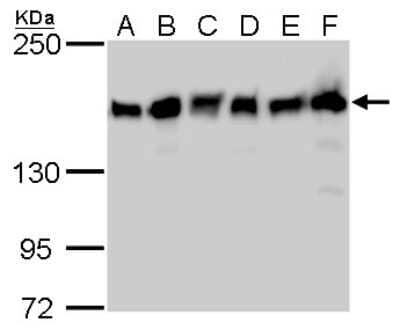 Western Blot: ROCK1 Antibody (464) [NBP2-42918]