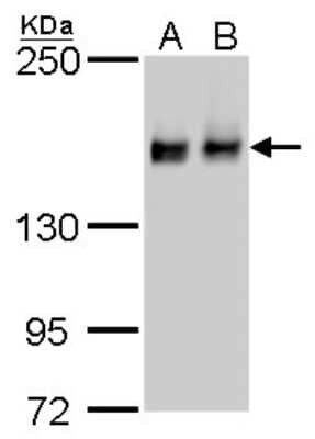 Western Blot: ROCK1 Antibody (464) [NBP2-42918]