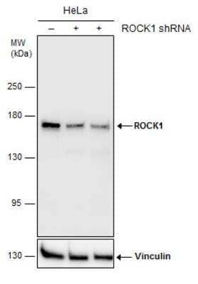 Western Blot: ROCK1 Antibody (464) [NBP2-42918]