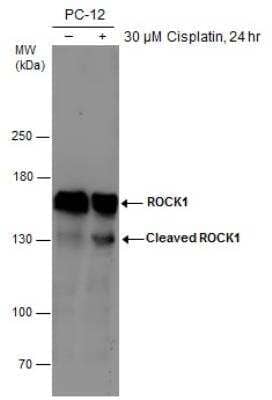 Western Blot: ROCK1 Antibody (464) [NBP2-42918]
