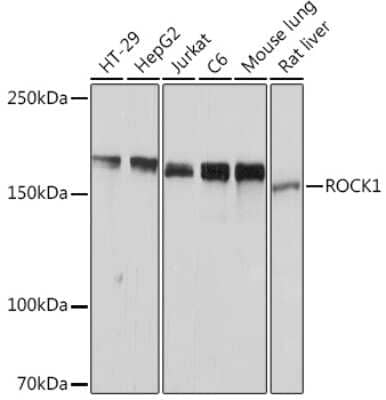 Western Blot: ROCK1 Antibody (H5E4) [NBP3-15350]