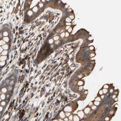 Immunohistochemistry-Paraffin: ROCK1 Antibody [NBP1-82450]