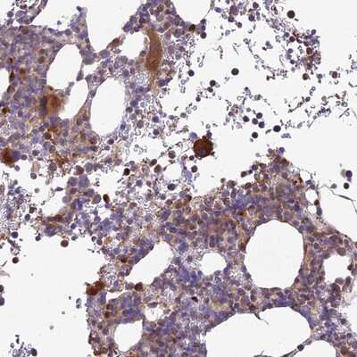 Immunohistochemistry-Paraffin: ROCK1 Antibody [NBP2-13244]