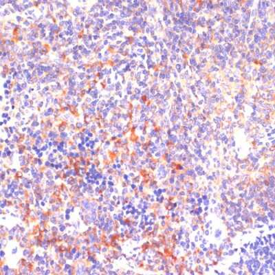 Immunohistochemistry-Paraffin: ROCK1 Antibody - BSA Free [NBP3-03713]