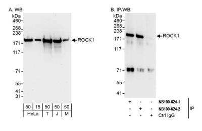 Western Blot: ROCK1 Antibody [NB100-624]