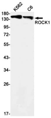 Western Blot: ROCK1 Antibody (S06-9A5) [NBP3-19762]