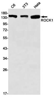 Western Blot: ROCK1 Antibody (S09-3D3) [NBP3-14972]