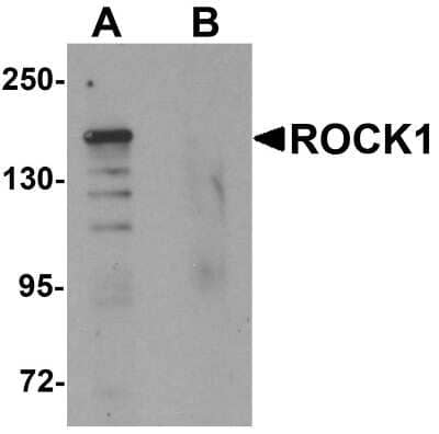 Western Blot: ROCK1 AntibodyBSA Free [NBP1-76569]