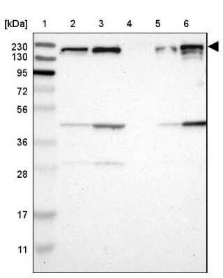 Western Blot: ROCK1 Antibody [NBP1-82450]