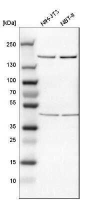 Western Blot: ROCK1 Antibody [NBP1-82450]