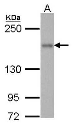 Western Blot: ROCK1 Antibody [NBP2-19297]