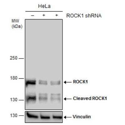 Western Blot: ROCK1 Antibody [NBP2-19297]