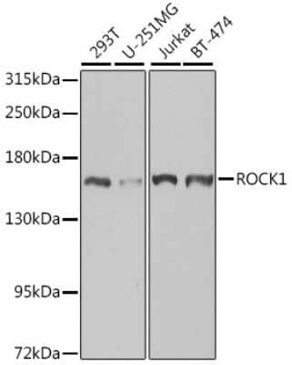 Western Blot: ROCK1 AntibodyBSA Free [NBP3-03713]