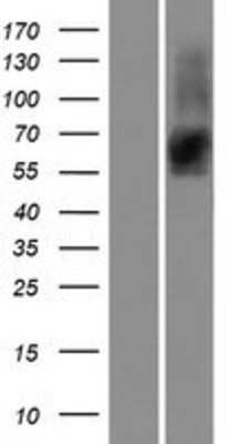 Western Blot: ROCK1 Overexpression Lysate [NBP2-07756]