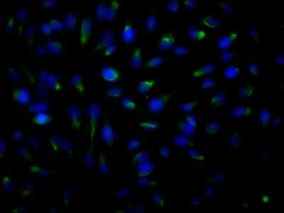 Immunocytochemistry/ Immunofluorescence: ROCK2 Antibody (10E1) [NBP3-15152]