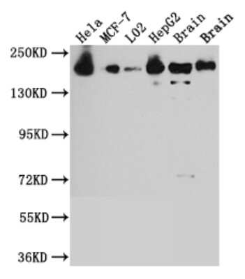 Western Blot: ROCK2 Antibody (10E1) [NBP3-15152]