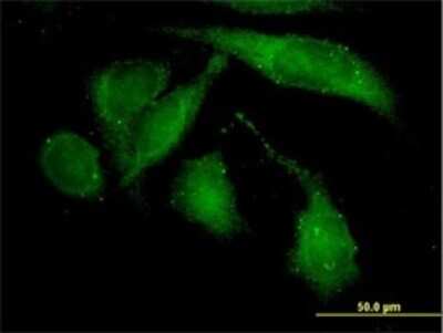 Immunocytochemistry/ Immunofluorescence: ROCK2 Antibody (1E12) [H00009475-M02]