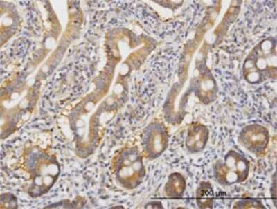 Immunohistochemistry-Paraffin: ROCK2 Antibody (1E12) [H00009475-M02]