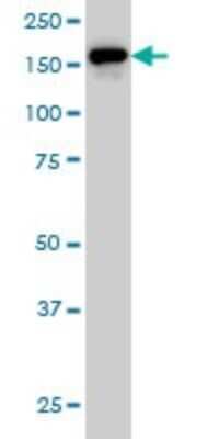 Western Blot: ROCK2 Antibody (2A4) [H00009475-M01]