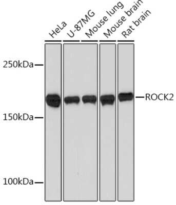 Western Blot: ROCK2 Antibody (8G3U2) [NBP3-16123]