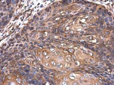 Immunohistochemistry-Paraffin: ROCK2 Antibody (GT11712) [NBP3-13535]