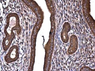 Immunohistochemistry-Paraffin: ROCK2 Antibody (GT11712) [NBP3-13535]