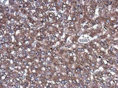 Immunohistochemistry-Paraffin: ROCK2 Antibody (GT11712) [NBP3-13535]