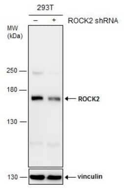Western Blot: ROCK2 Antibody (GT11712) [NBP3-13535]
