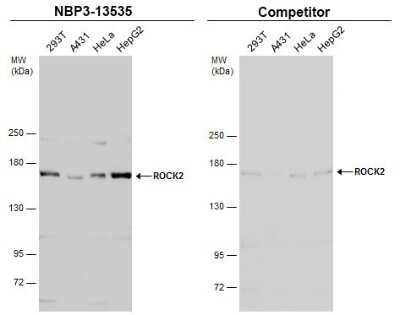 Western Blot: ROCK2 Antibody (GT11712) [NBP3-13535]