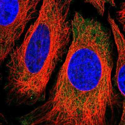 Immunocytochemistry/ Immunofluorescence: ROCK2 Antibody [NBP2-58122]