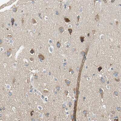 Immunohistochemistry-Paraffin: ROCK2 Antibody [NBP1-86124]