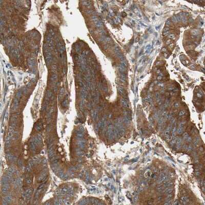 Immunohistochemistry-Paraffin: ROCK2 Antibody [NBP1-86124]