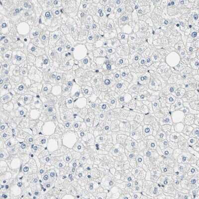 Immunohistochemistry-Paraffin: ROCK2 Antibody [NBP1-86124]