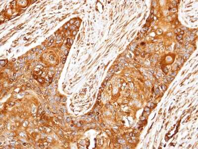 Immunohistochemistry-Paraffin: ROCK2 Antibody [NBP2-20199]