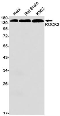 Western Blot: ROCK2 Antibody (S01-4F1) [NBP3-19508]