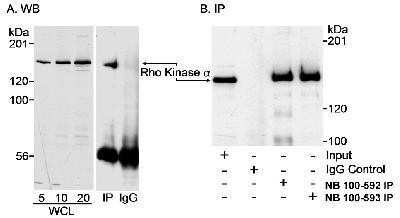 Western Blot: ROCK2 Antibody [NB100-593]