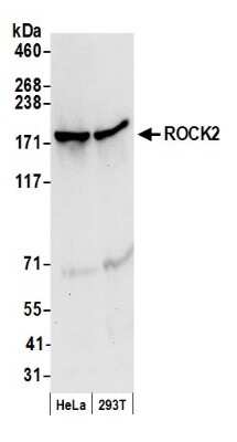 Western Blot: ROCK2 Antibody [NB100-593]