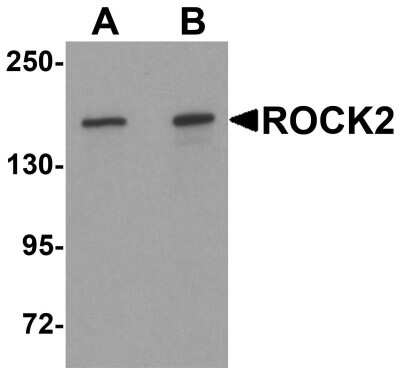 Western Blot: ROCK2 AntibodyBSA Free [NBP1-76570]