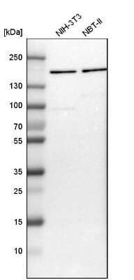 Western Blot: ROCK2 Antibody [NBP1-86124]