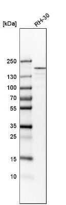 Western Blot: ROCK2 Antibody [NBP1-86124]