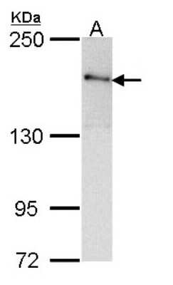 Western Blot: ROCK2 Antibody [NBP2-20199]