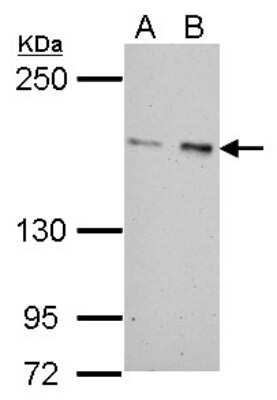 Western Blot: ROCK2 Antibody [NBP2-20199]