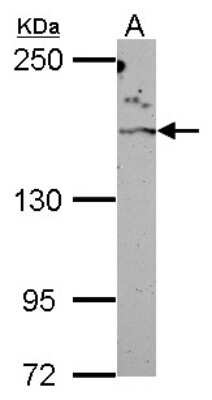 Western Blot: ROCK2 Antibody [NBP2-20199]